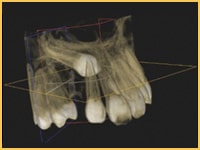 Accurate measurements and localization of impacted teeth.