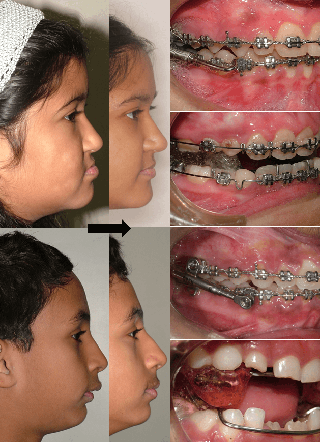 Dentofacial-orthopaedics-1
