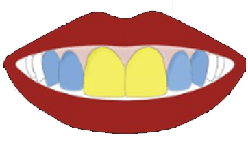 Dominance-Of-Central-Incisors-–-In-Yellow