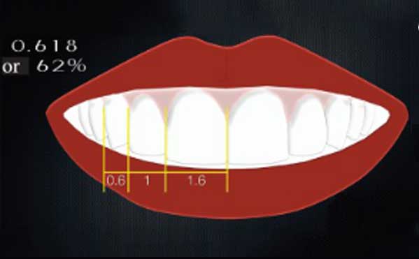 Smile-with-golden-ratio-(62%)-between-teeth-in-the-esthetic-zone.