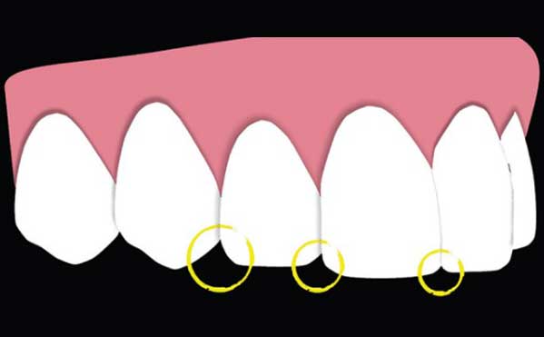 Tooth-color-and-anatomical-shape
