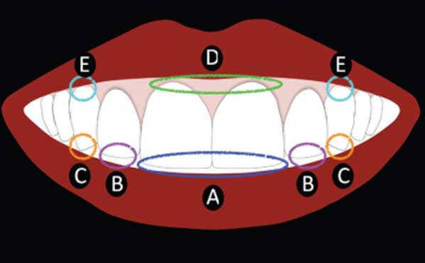 Visual-proportion-amongst-maxillary-front-teeth