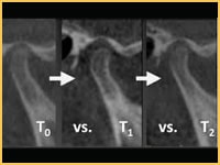 View condylar positions and temporomandibular joint (TMJ) pathology.