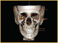 Identifies and quantifies facial asymmetry.