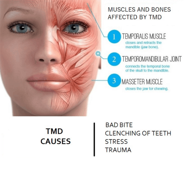 Temporomandibular Disorders - Smiles N Faces