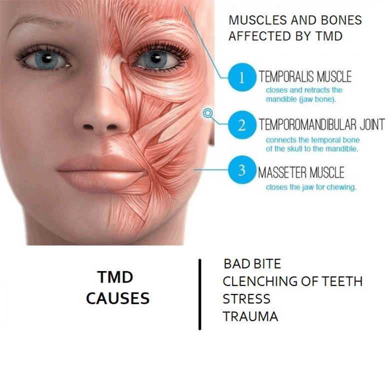 what-causes-TMD
